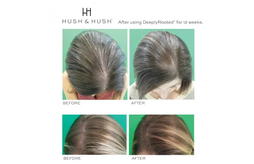 CAPELLI FRAGILI E SOTTILI? CAUSE E RIMEDI!