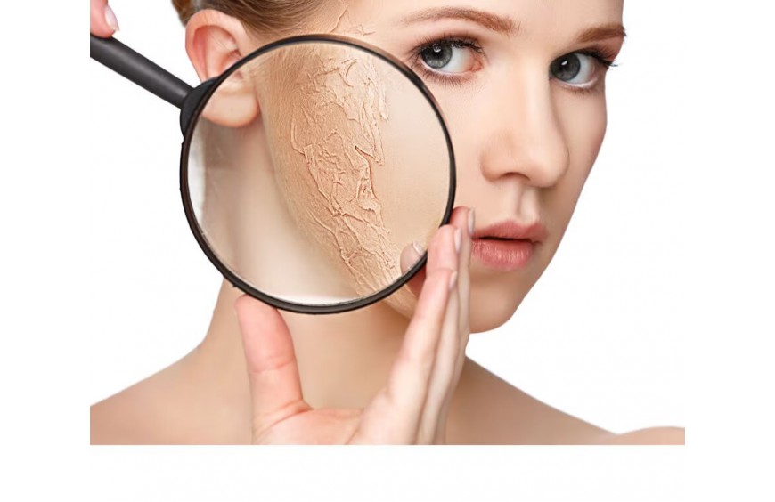 Come combattere la pelle secca e rivitalizzarla in modo efficace