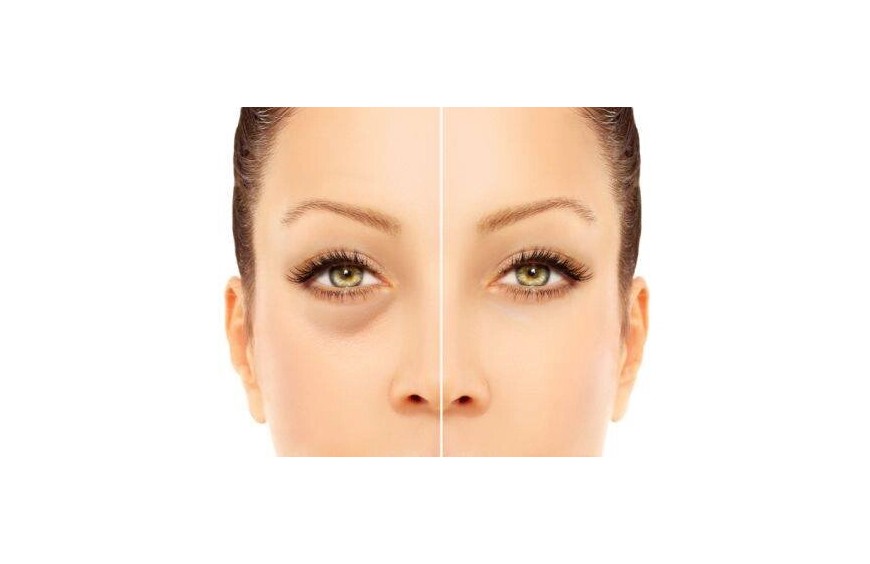 A COSA SERVE IL CORRETTORE